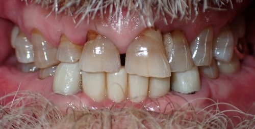 Oz before