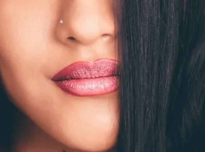 4 Things you need to know about dermal fillers
