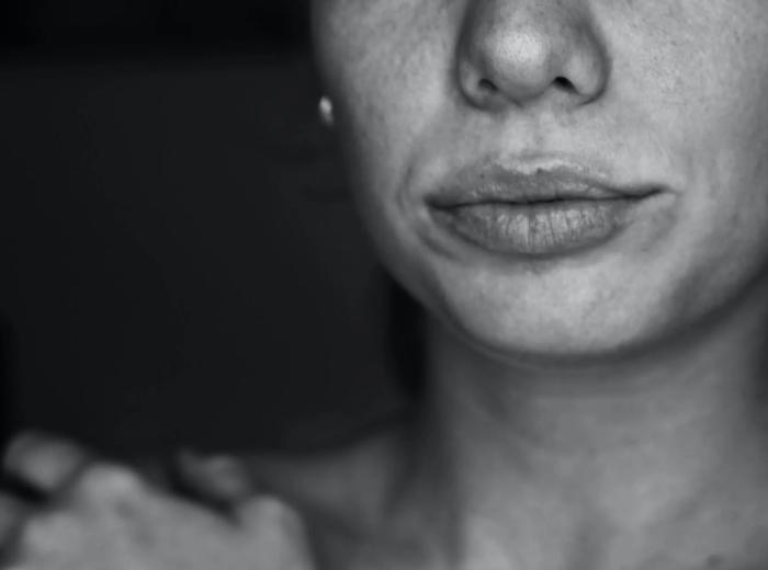 What to do if you have an infected tooth