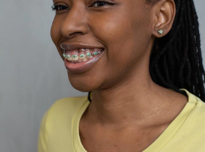 7 Tips for dealing with painful braces